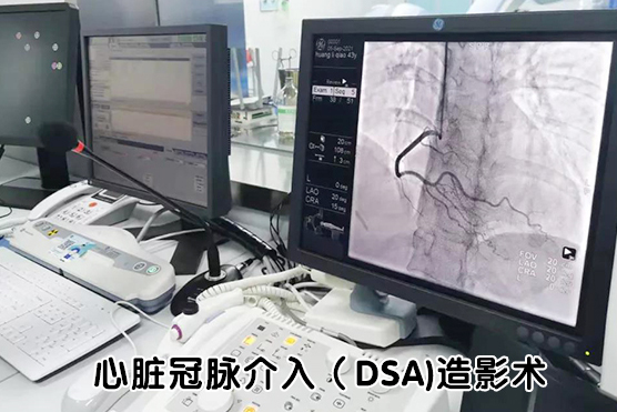 心脏冠脉介入 